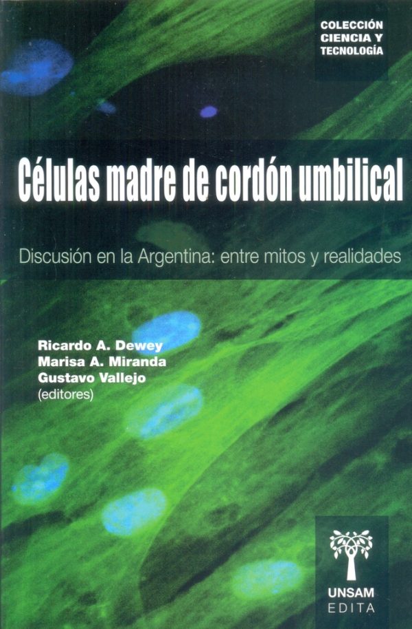 Células madre de cordón umbilical